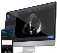 Viz.ai, Cortechs.ai Collaborate to Treat Neurodegenerative Diseases