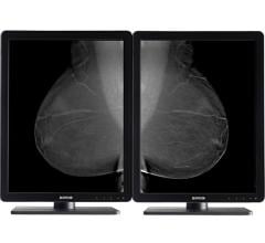 Barco, Nio 5MP LED, flat panel displays, mammography