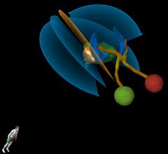 brainlab, cranial radiosurgery, radiation therapy, AAPM