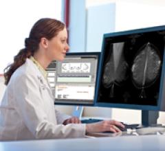 digital breast tomosynthesis, Time, leading healthcare advances, 2014, DBT