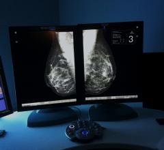 Densitas, Research Edition, mammography, breast density, ECR 2015