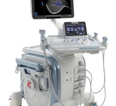 Esaote eHD Technology Cardiovascular Ultrasound RSNA 2013 