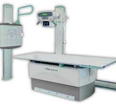fujifilm fdr d-evo suite fs x-ray systems digital radiography dr rsna 2013