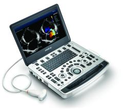  Mindray Introduces Point-of-Care Ultrasound System at ACEP