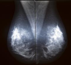 Novarad, NovaMG, mammography viewer, NovaPACS