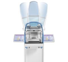 Planmed, Planmed Clarity 3D, DBT, digital breast tomosynthesis
