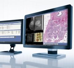 Sectra, digital pathology solution, PACS, Netherlands