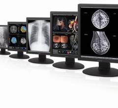 Full line of monitors for radiology