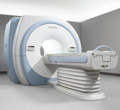 Vantage titan 3T MRI