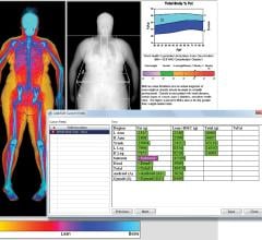 DICOM Structured Reporting, Radiologist, Q/ris 3000 Structured Report module