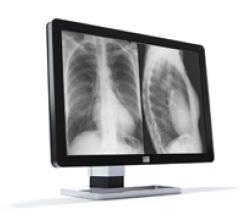 X455_Barco_Coronis Fusion10MP