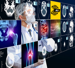 Building on its commitment to providing customers with artificial intelligence (AI) solutions that can be utilized across modalities in routine care, Canon Medical Systems USA, Inc. is partnering with Zebra Medical Vision to offer its AI1 automated imaging analysis solutions to help clinicians in the U.S. provide faster, accurate diagnoses for optimized patient care