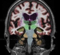 WEBINAR: Neuroimaging from a Clinical MRI Perspective, sponsored by Philips Healthcare. How to better manage your MRI department.