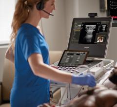 New Ultrasound Compact System 5000 Series delivers premium image quality needed to aid in a confident diagnosis in a portable unit