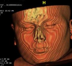 CT systems, Clinical trial/study, ARRS