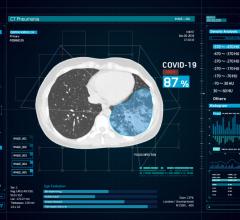AI vendor Infervision's InferRead CT Pneumonia software uses artificial intelligence-assisted diagnosis to improve the overall efficiency of the radiology department. It is being developed in China as a high sensitivity detection aid for novel coronavirus pneumonia (COVID-19). #COVID19 #coronavirus #SARScov2