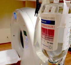 Iodine-based CT contrast ready for scanning with a Canon Aquilion One 320-slice CT system at Northwestern Medicine Central DuPage Hospital in the Chicago suburbs.