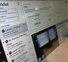 CT imaging radiation dose tracking software from Imalogix displayed at RSNA 2019.