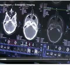 radiology videos, video, ITNtv, ITN TV