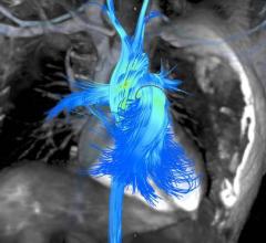 Arterys, Cardiac MRI, cardiac MRI advances