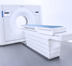 CT, computed tomography