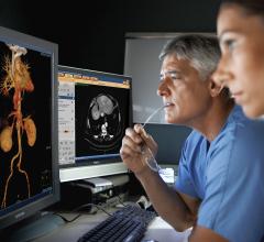 Cardiologists using the Philips spectral CT software to view a spectral CT image reconstruction at various energy levels.