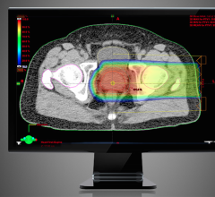 proton treatment planning, prostate