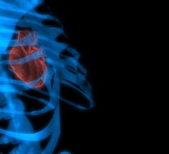 Bonn Call for Action, FDA, radiation exposure, medical imaging, update