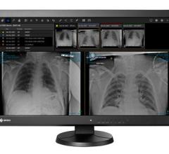Solution provides essential mobility for radiologists displaced from standard work environments