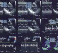 The American Institute of Ultrasound in Medicine Ultrasound First Forum 