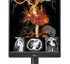 LG Business Solutions USA is introducing a new oxide-based thin-film-transistor Digital X-ray Detector (DXD) and 21-inch 3MP diagnostic monitor at RSNA 2021.