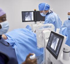 Offering surgeons greater flexibility, control, and personalization in C-arm operation and image acquisition, Philips’ new Zenition 30 reduces dependency on technician support for a wide variety of minimally invasive procedures  
