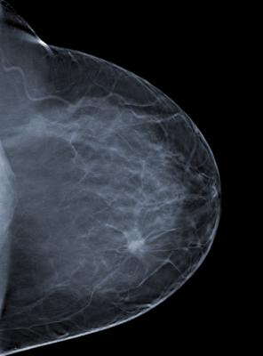 Breast Density and Mammography Reporting Act Kuster Women's Health