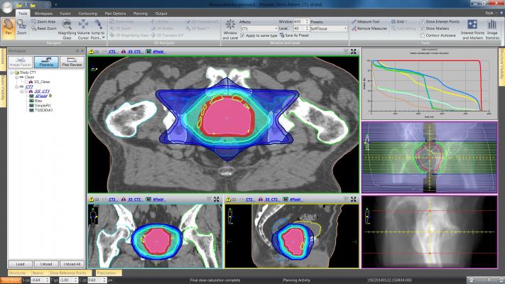 high-risk prostate cancer, radical local treatment, Umea University Sweden study, mortality