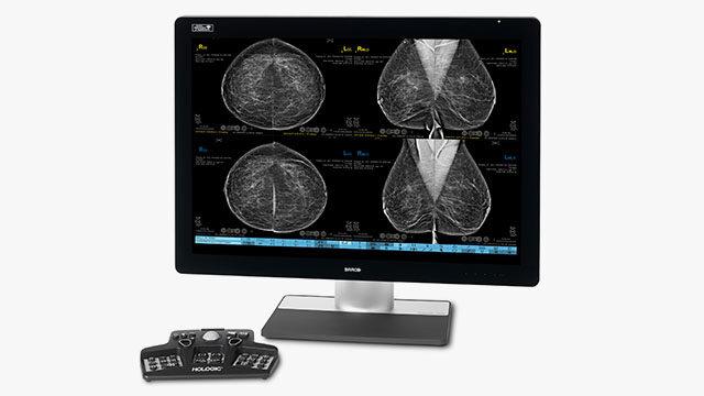 Hologic, Inc. will showcase their comprehensive portfolio of breast and skeletal health solutions at the annual European Congress of Radiology (ECR) in Vienna, Austria from July 13-17 