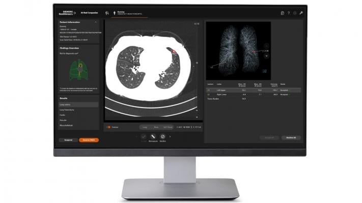 During the virtual 106th Scientific Assembly and Annual Meeting of the Radiological Society of North America (RSNA), Nov. 29 to Dec. 5, Siemens Healthineers announced the Food and Drug Administration (FDA) clearance of AI-Rad Companion Organs RT, the latest Siemens Healthineers artificial intelligence-based software assistant in the AI-Rad Companion family. 