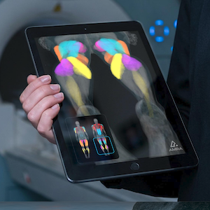 Measuring Muscles with Quantitative MR