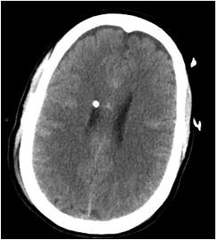 American Society of Neuroradiology Honors Peter Chang with Cornelius G. Dyke Memorial Award