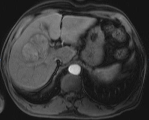 ASTRO and ASCO Launch New Cancer Care Quality Registry