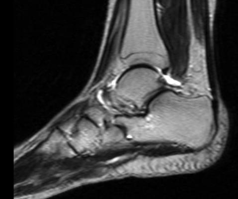 Musculoskeletal Extremity Imaging In Medicare Beneficiaries Increased Over Two Decades Imaging Technology News