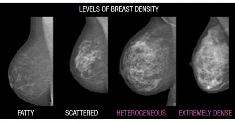 Volpara's breast density scale