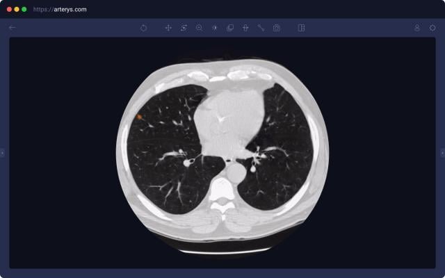 Arterys Demonstrates AI Cloud-Based Medical Image Analysis Solutions at RSNA 2018