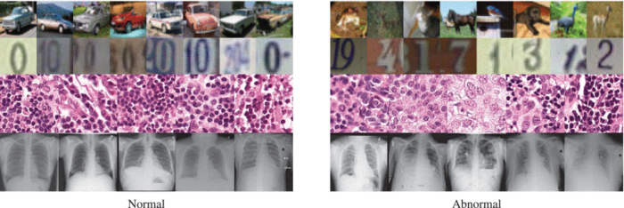 The top two rows show images of cars and digits. Given such data, conventional methods are fairly good at spotting anomalies (right) among ordinary cases (left). The bottom two rows show medical scans — these prove to be more difficult. Image courtesy of Nina Shvetsova et al./IEEE Access