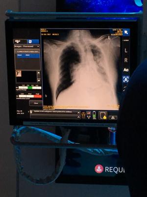 European Society of Radiology and GE Partner on Artificial Intelligence for ECR 2019