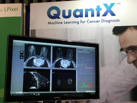 Artificial Intelligence Could Yield More Accurate Breast Cancer Diagnoses