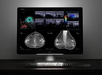 Barco Shares Latest Advances in Multimodality Diagnostic Imaging at RSNA 2017