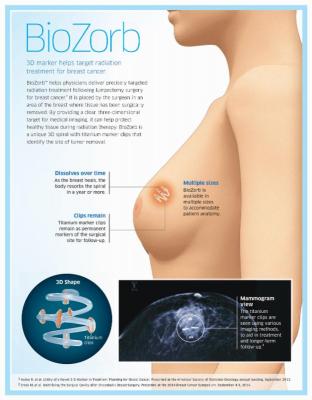 BioZorb, Focal Therapeutics, breast cancer, Schonholz, conference