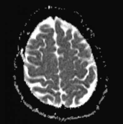 Weizmann Institute, autism spectrum disorder, fMRI, study, connectivity