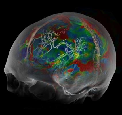 brain scans, neuroimaging, psychotherapy response, anxiety and depression, Harvard Reviw of Psychiatry