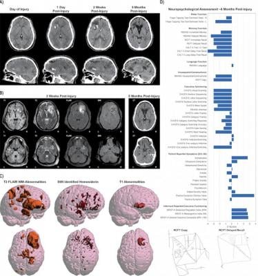 This illustration show the complexity of the data obtained from one single patient with moderate/severe traumatic brain injury. Different imaging approaches and techniques have their own unique sensitivity in assessing different aspects of neuroanatomy and neuropathology. What can be seen on images also changes with time since injury. Data from comprehensive clinical and functional assessments using a range of other tools is also important for evaluating patient outcome. Through data harmonization and large